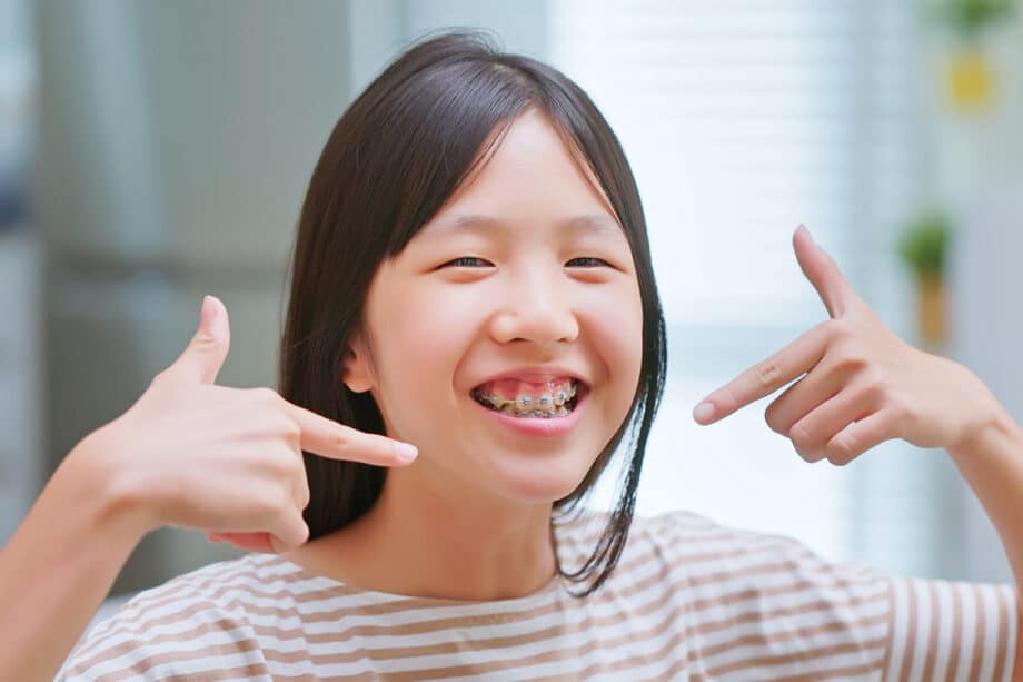 How Long Do Kids Usually Wear Braces? Timeline By Age