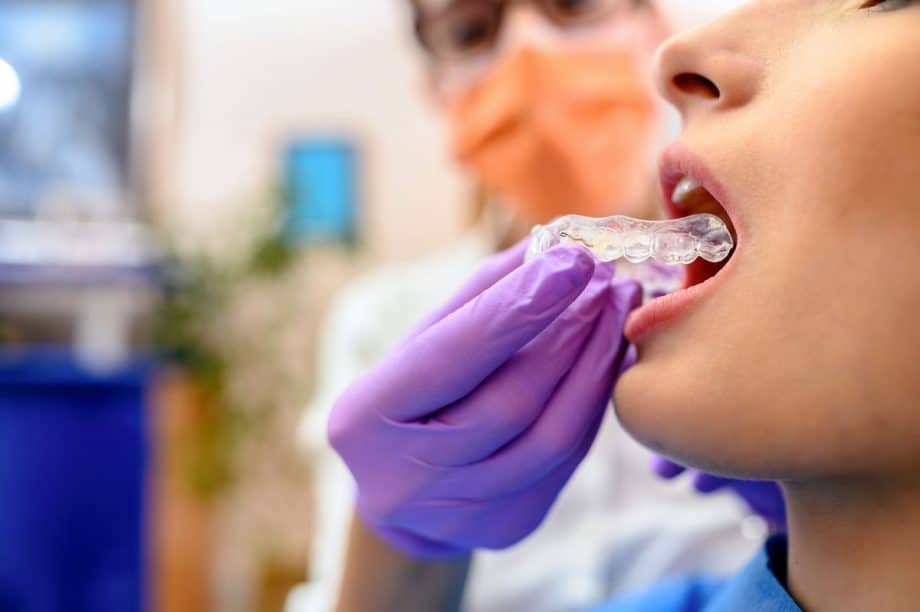 dental professional inserts dental retainer into patient's mouth